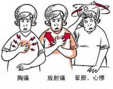 冠心病有哪些癥狀？