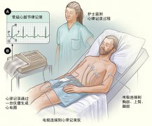 冠心病需要做哪些檢查？