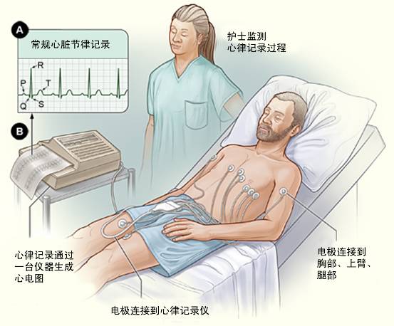 冠心病需要做哪些檢查？(圖1)