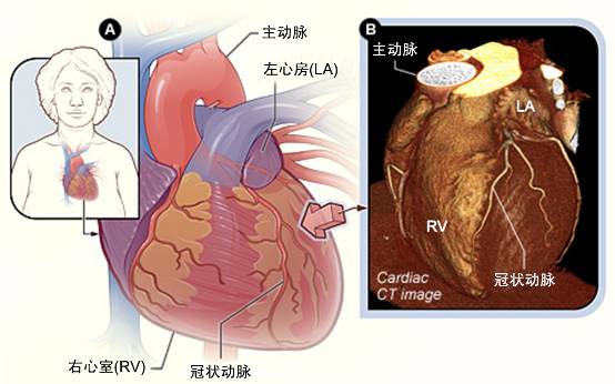 冠心病需要做哪些檢查？(圖2)